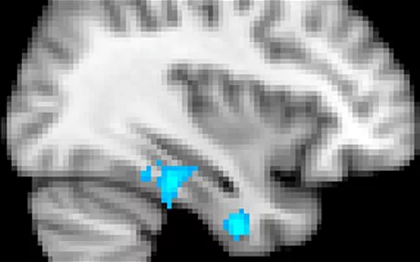 Figure 2: The brain shows minimal activity when the text is translated into 'modern' prose